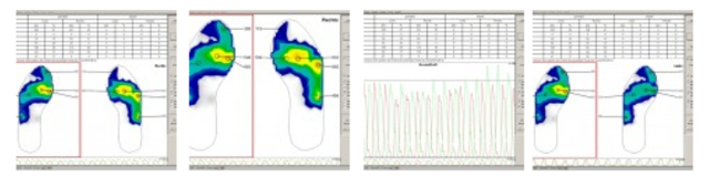 Drukpuntmeting in de schoenen tijdens het fietsen